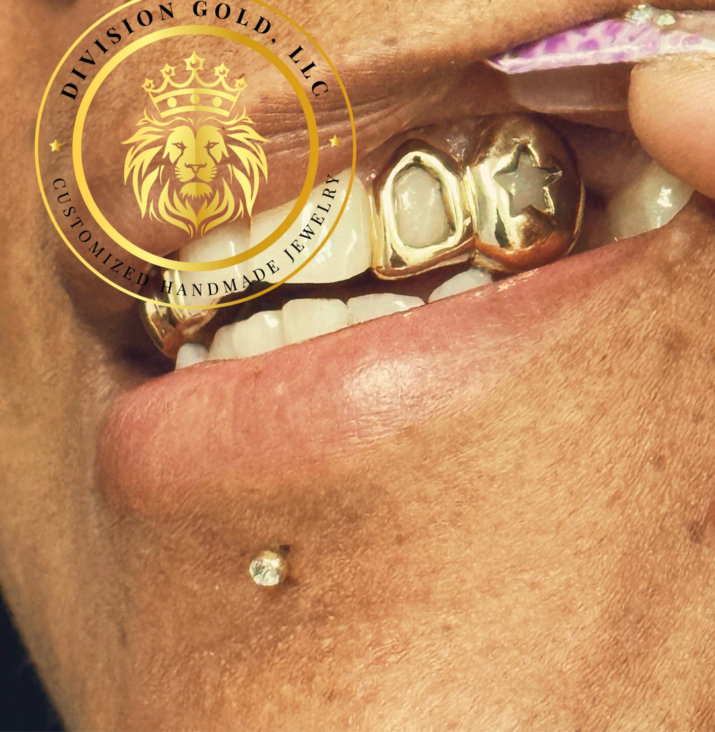 Custom NPG Dental Gold Grillz Bottom Bar Grill + Mossanite 6 Bottom