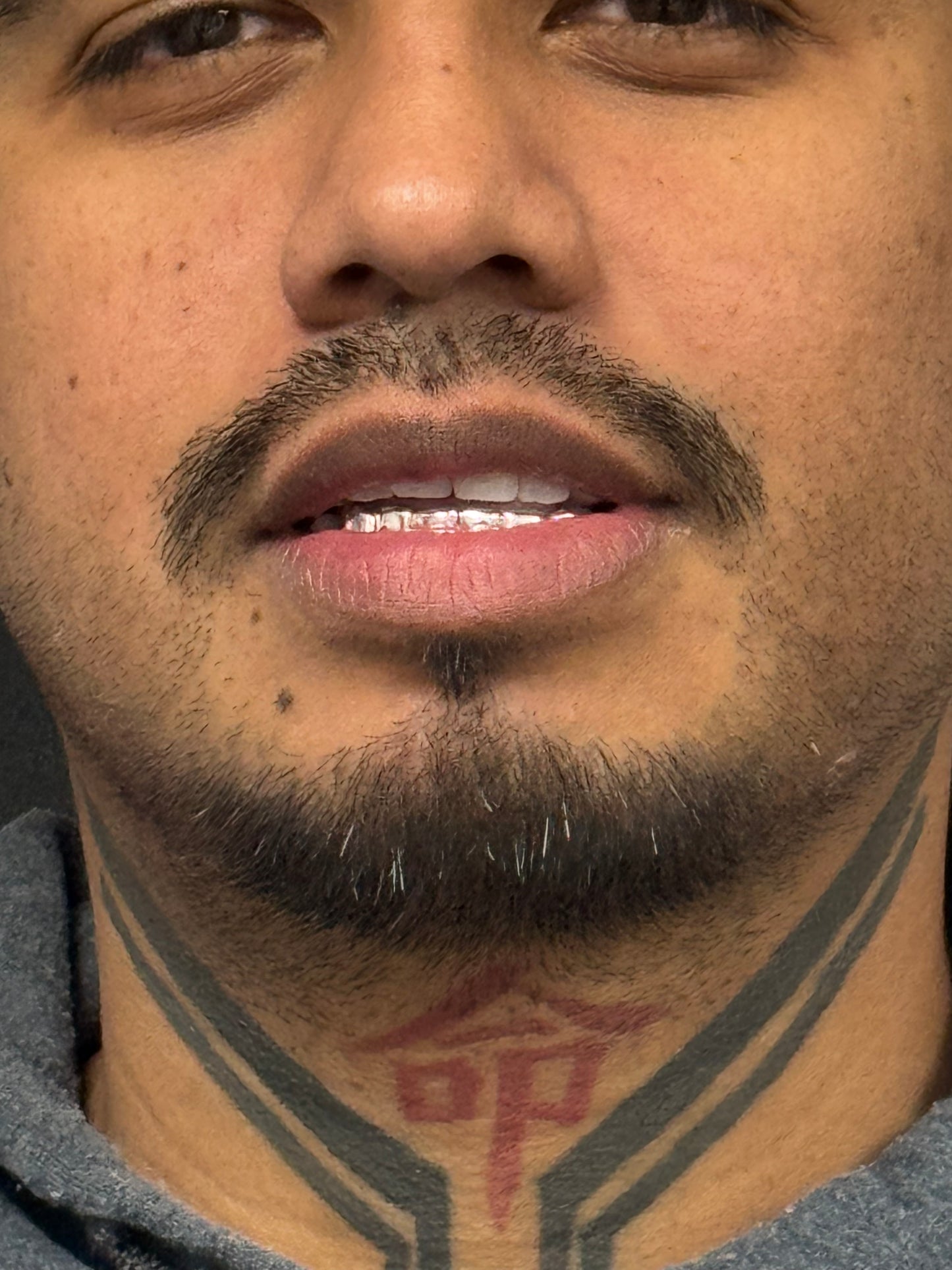 965 High Purity Silver Real Solid silver Grillz Top Or Bottom Perm-Cut Grills