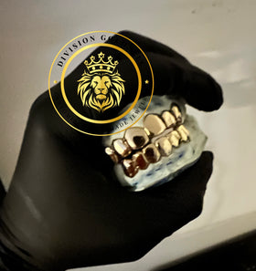 NPG Dental Gold Perm-Cut Grillz