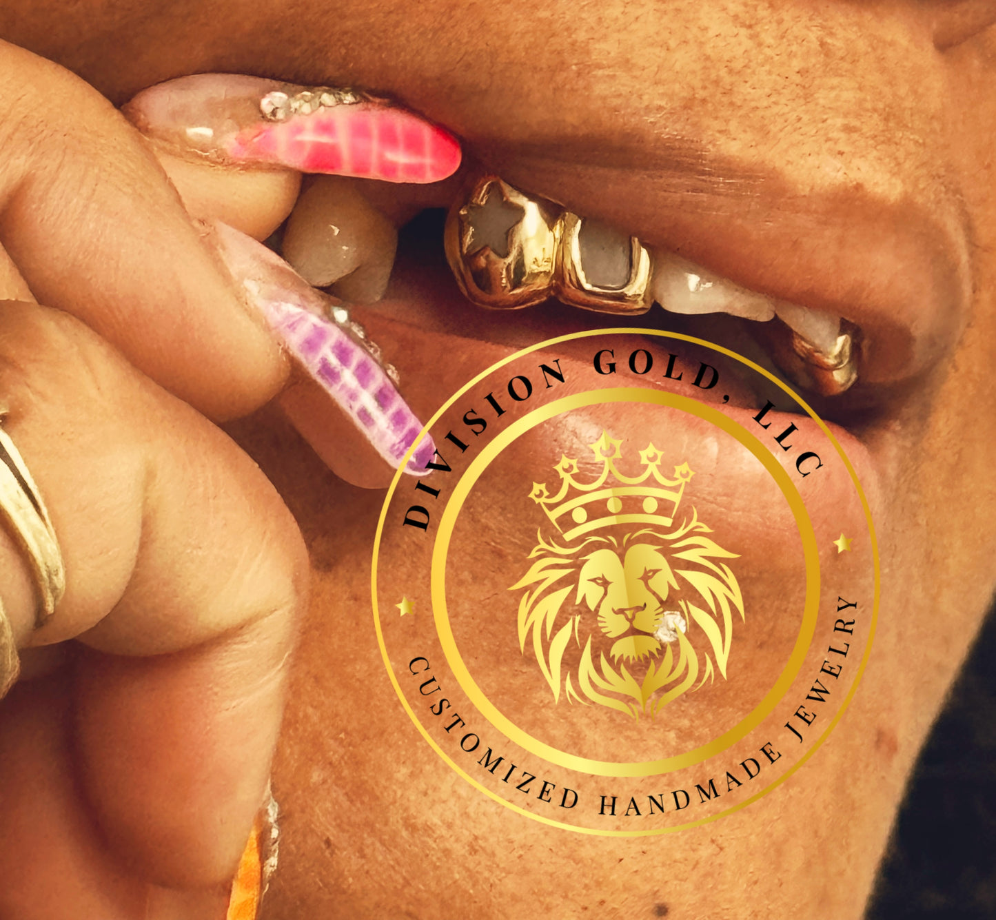 Custom NPG Dental Gold Grillz Bottom Bar Grill + Mossanite 6 Bottom