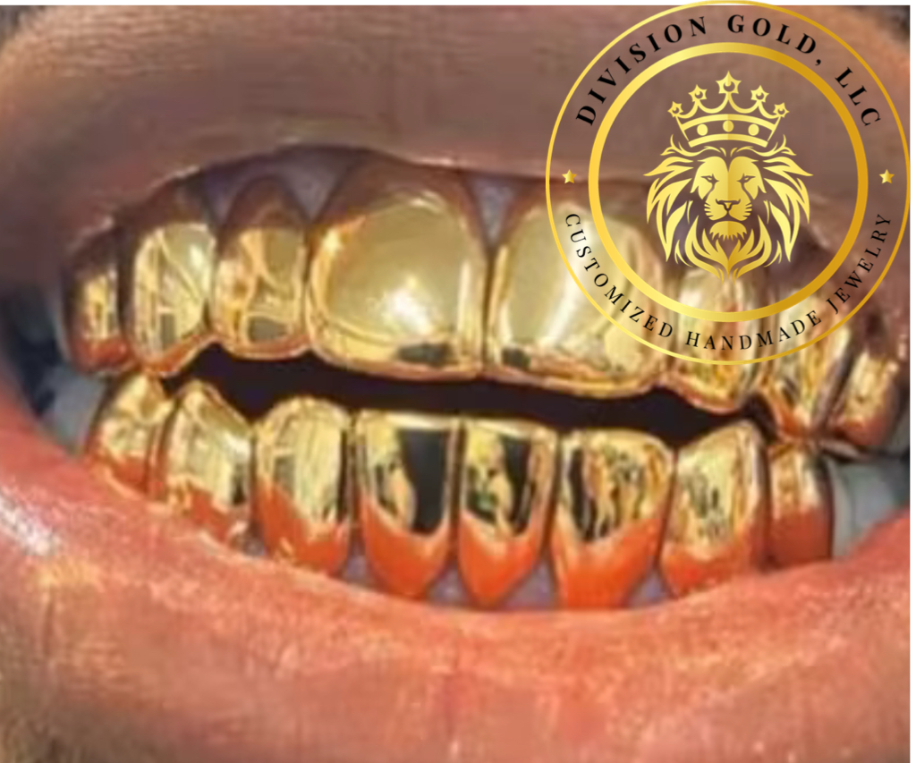 NPG Dental Gold Grillz Top Or Bottom Perm-Cut